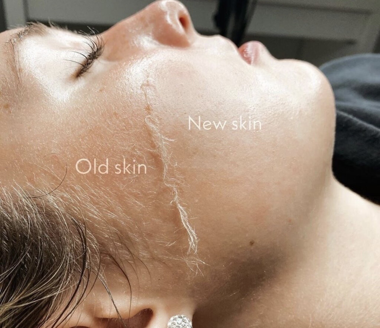 Facial skin treatment results at The LDP Edit